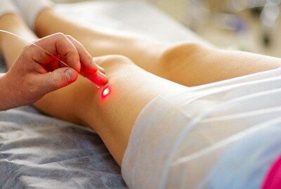 Лазерная терапия против рубцов Лазерная терапия против рубцов