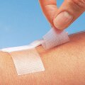 Надежное средство от рубцов – силиконовый пластырь Надежное средство от рубцов – силиконовый пластырь