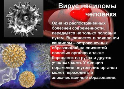 Симптомы вируса папилломы человека